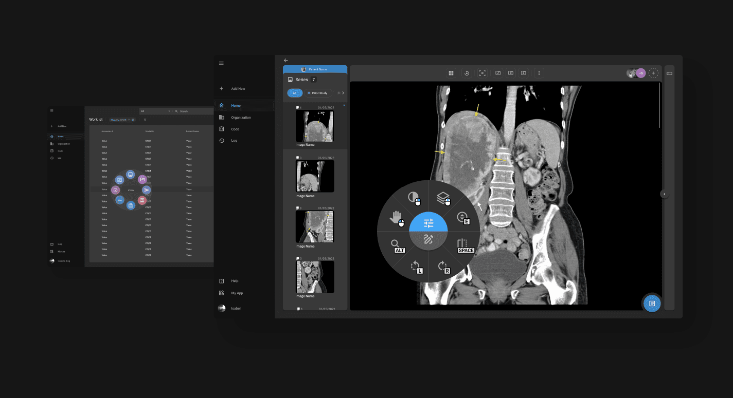 OmegaAI imaging viewer with worklist and radial tool menu